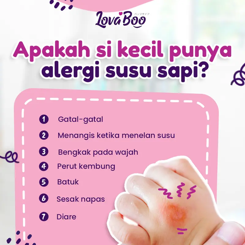 Konten edukasi ciri-ciri anak alergi susu sapi oleh Lovaboo Instagram
