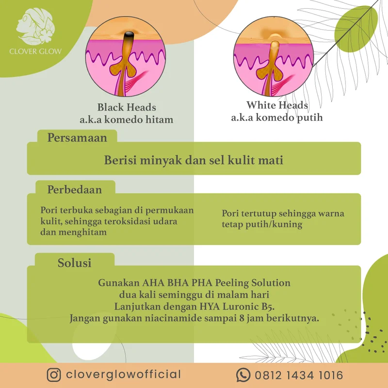 Konten edukasi Cloverglow: Blackheads vs Whiteheads