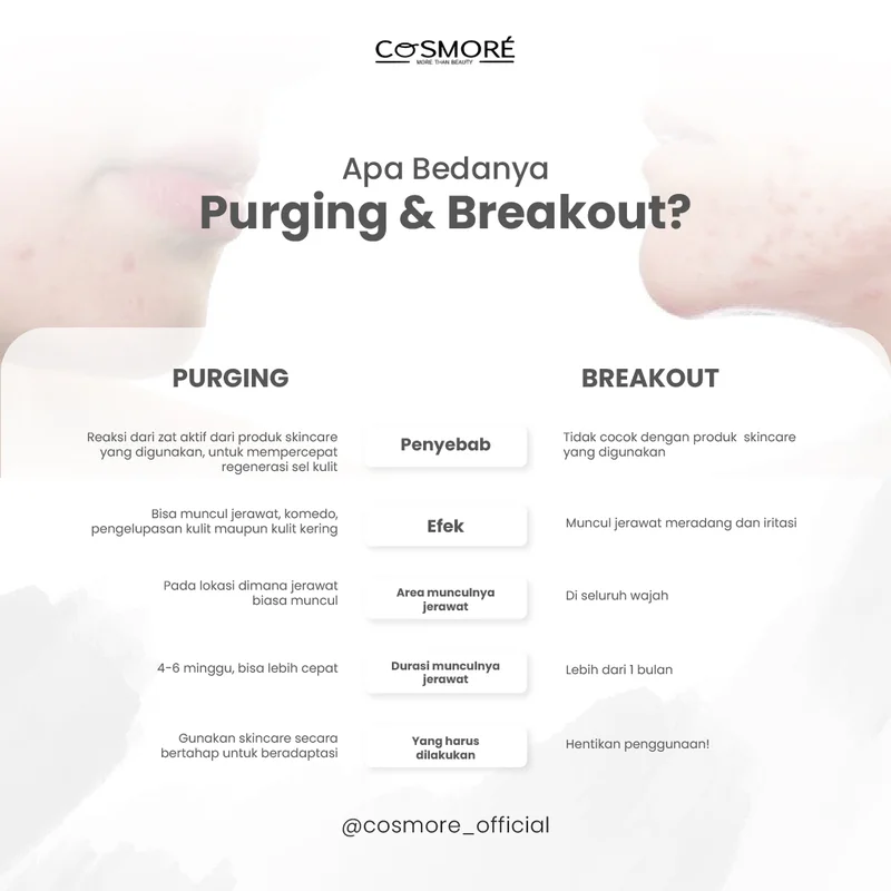 Konten edukatif Cosmore tentang purging dan breakout perbedaan skincare