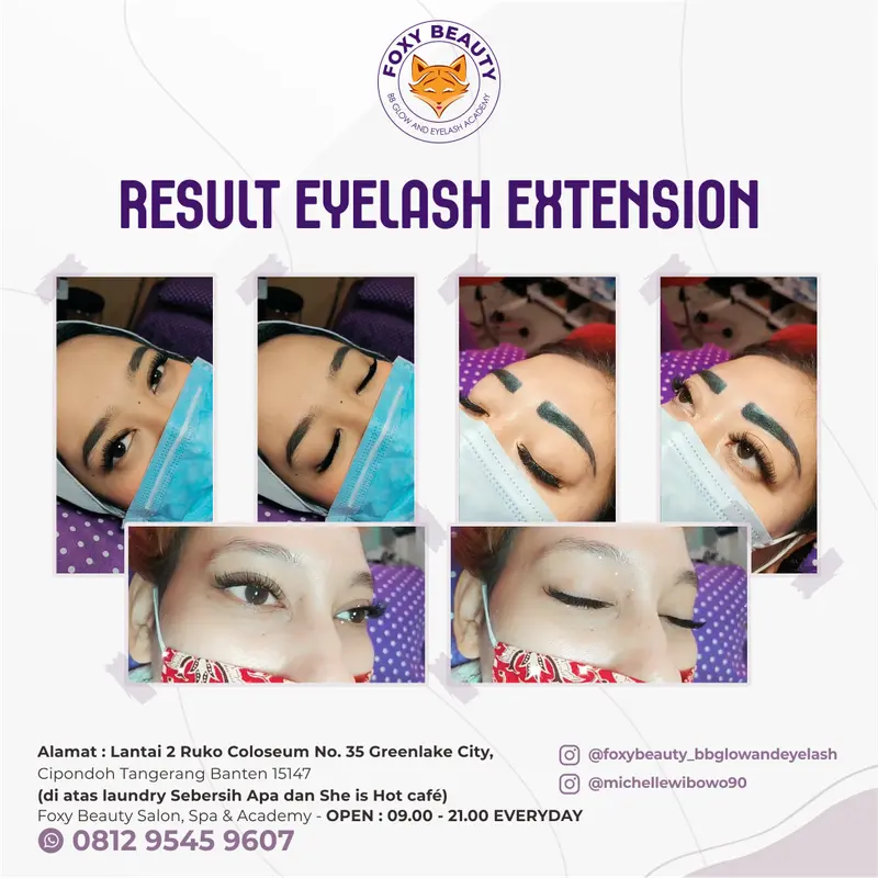 Hasil treatment kecantikan Foxy Beauty BBGlow Surabaya