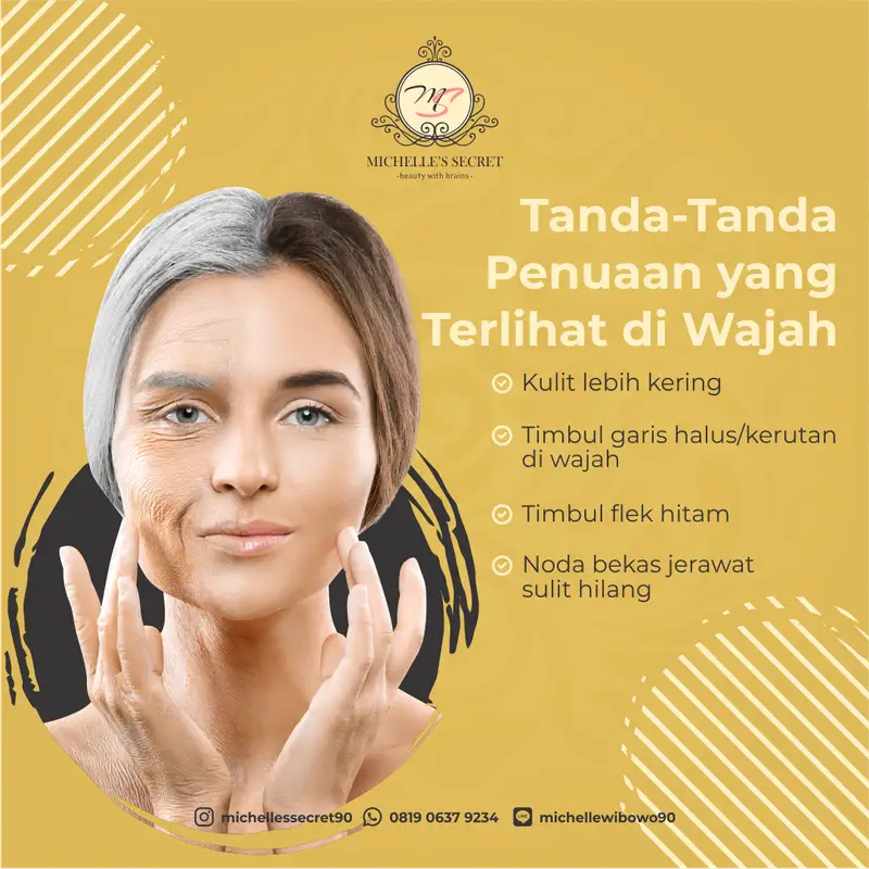 Desain konten Instagram Michelle Secret tentang tanda-tanda penuaan kulit wajah