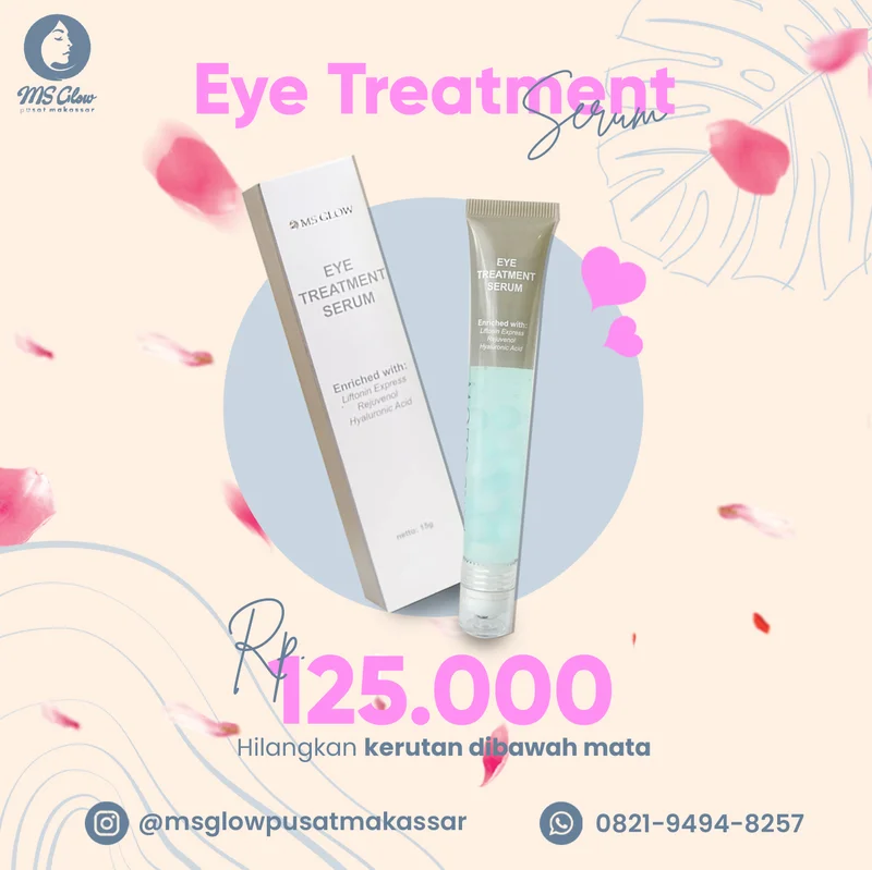 Feed Instagram Eye Treatment Serum MS Glow Pusat Makassar