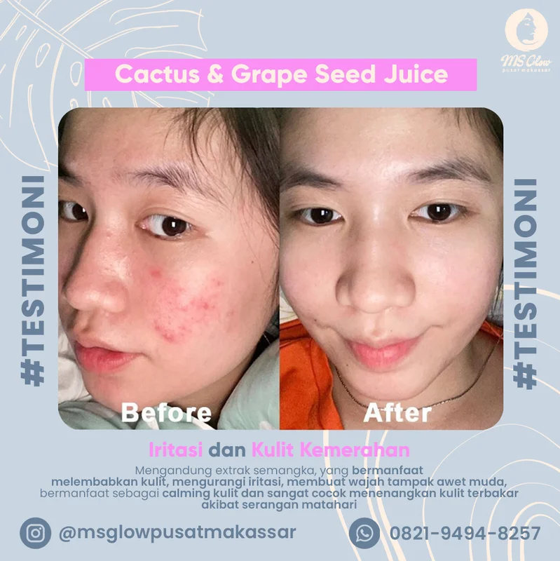 Contoh konten feed testimoni pelanggan MS Glow Pusat Makassar